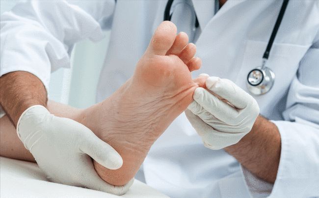 华医皮肤病医院：“脚气”怎么治才能根除？